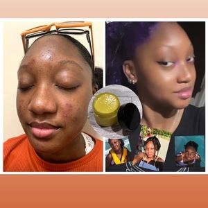 Turmeric brightening soap in a jar